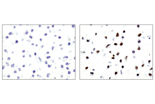 Immunohistochemistry Image 2: Phospho-Stat3 (Tyr705) (M9C6) Mouse Monoclonal Antibody (BSA and Azide Free)