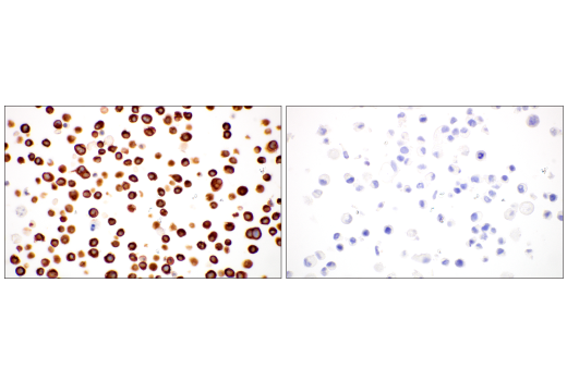 Immunohistochemistry Image 14: Nestin (E4O9E) Rabbit Monoclonal Antibody (BSA and Azide Free)