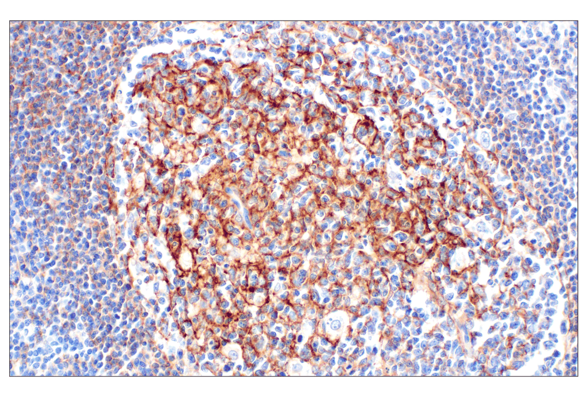 Immunohistochemistry Image 2: CR1/CD35 (E8B1Z) Rabbit mAb