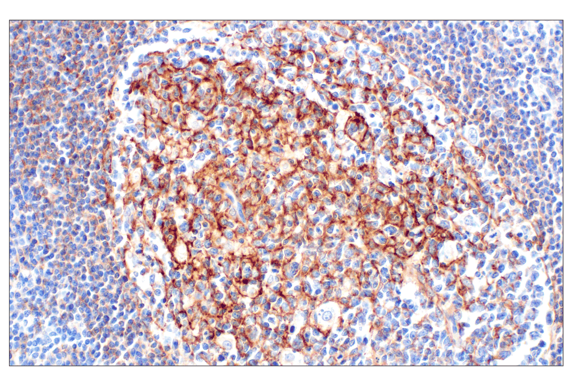 Immunohistochemistry Image 2: CR1/CD35 (E8B1Z) Rabbit Monoclonal Antibody