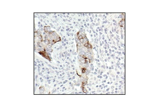 undefined Image 13: NF-κB Pathway Antibody Sampler Kit