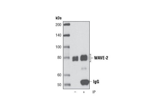 Immunoprecipitation Image 1: WAVE-2 (D2C8) XP<sup>®</sup> Rabbit mAb