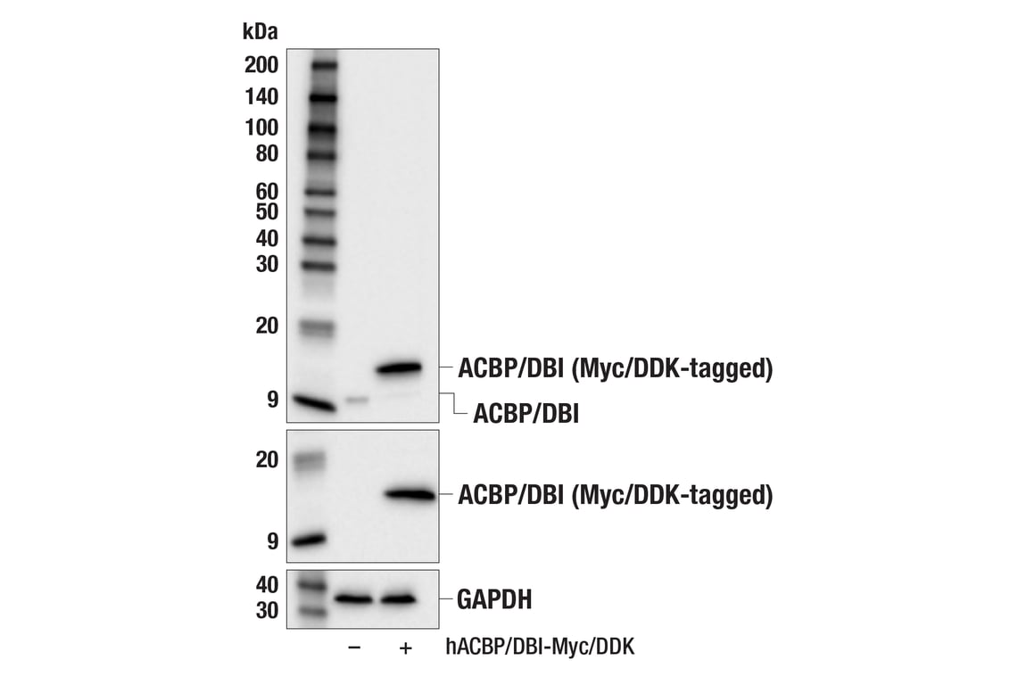 Western Blotting Image 2: ACBP/DBI (E6K8G) Rabbit Monoclonal Antibody