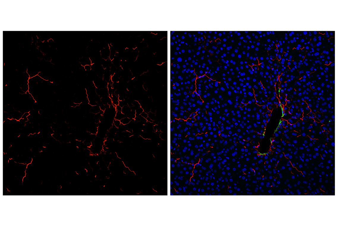 Immunofluorescence Image 2: COL1A1 (E8F4L) Rabbit Monoclonal Antibody (Alexa Fluor<sup>®</sup> 594 Conjugate)