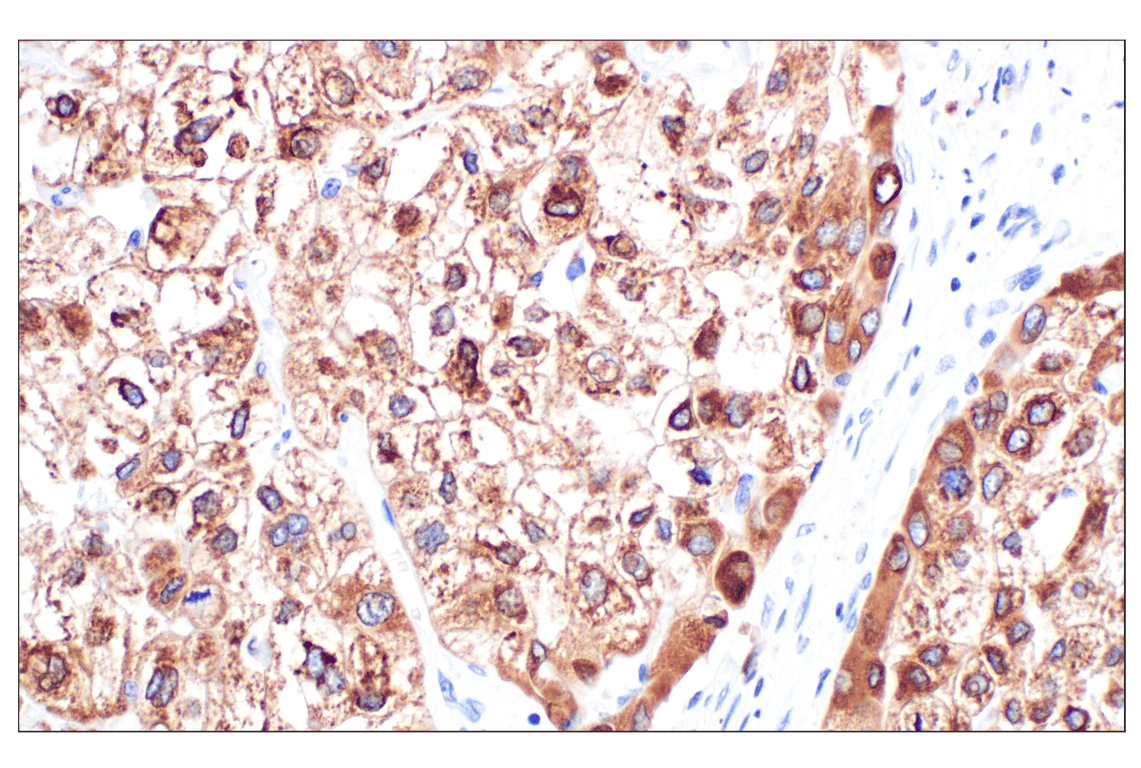 Immunohistochemistry Image 3: MGST1 (F6F5T) Rabbit Monoclonal Antibody