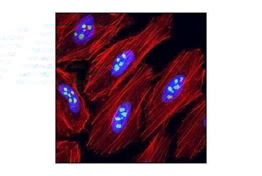 Immunofluorescence Image 1: eIF6 (D16E9) Rabbit Monoclonal Antibody