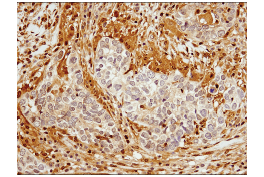 Immunohistochemistry Image 2: Stat3 (D1B2J) Rabbit Monoclonal Antibody (BSA and Azide Free)
