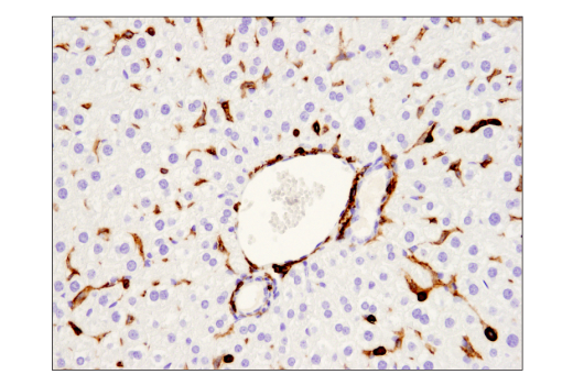 Immunohistochemistry Image 3: CD45 (D3F8Q) Rabbit Monoclonal Antibody (BSA and Azide Free)