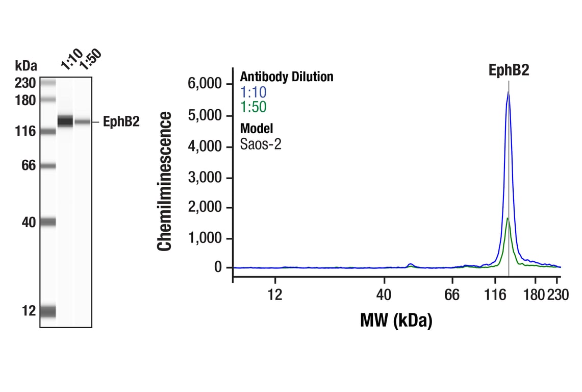 Western Blotting Image 1: EphB2 (D2X2I) Rabbit Monoclonal Antibody