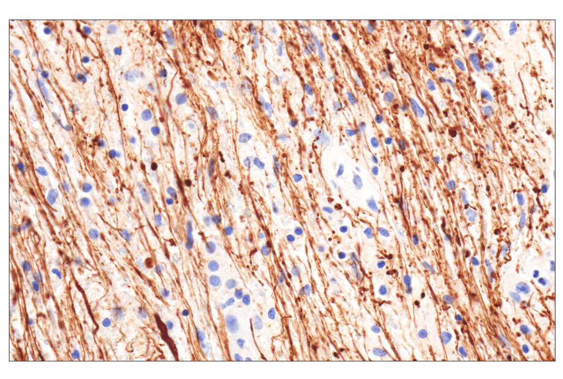 Immunohistochemistry Image 1: Neurofilament-M (E7L2T) Rabbit Monoclonal Antibody (BSA and Azide Free)