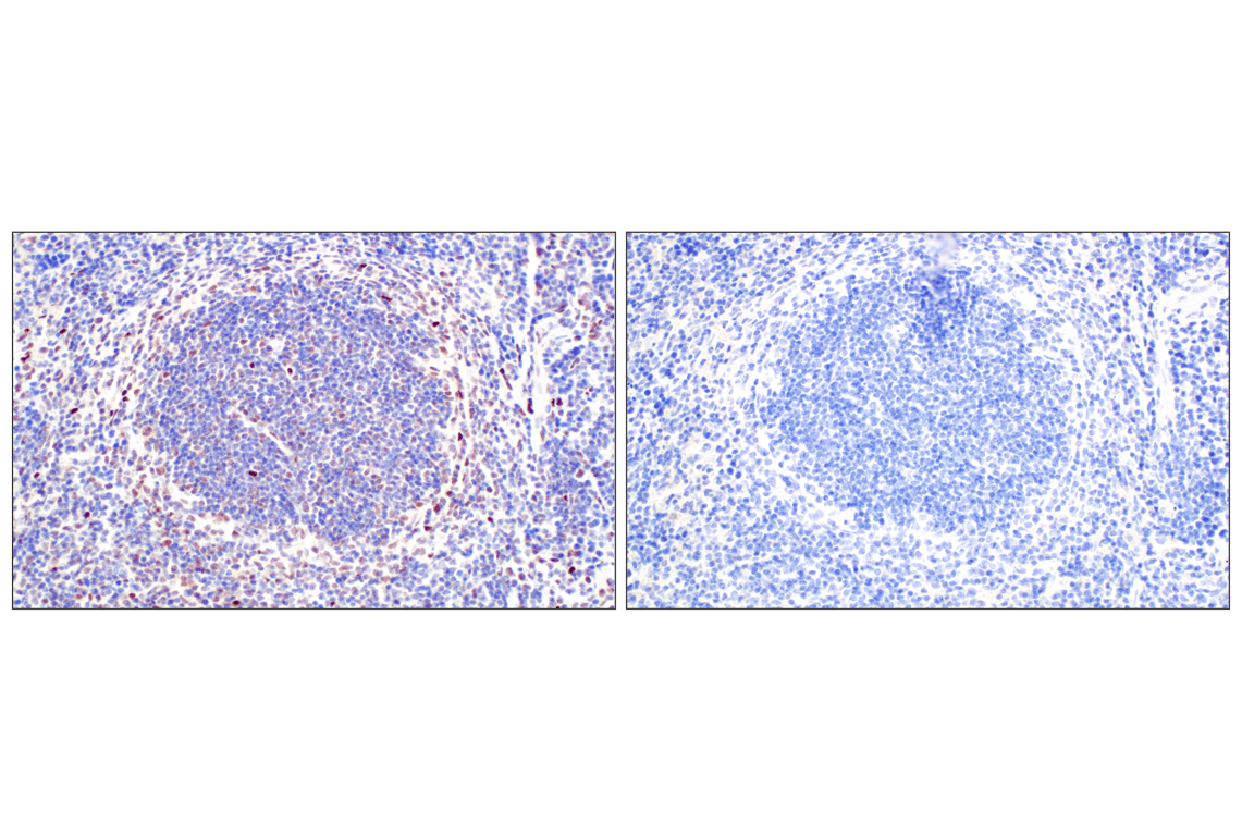 Immunohistochemistry Image 9: TCF4/ITF2 (E3X2Y) Rabbit Monoclonal Antibody