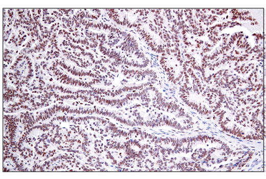 Immunohistochemistry Image 2: RAI17/ZMIZ1 (E2X3X) Rabbit Monoclonal Antibody
