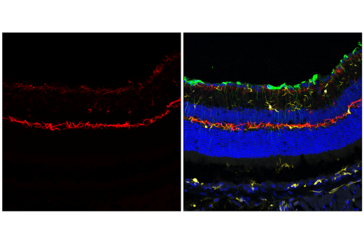 Immunofluorescence Image 3: Neurofilament-H (E7Z7G) Rabbit Monoclonal Antibody