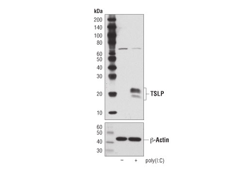 Western Blotting Image 2: TSLP (D7U1X) Rabbit Monoclonal Antibody