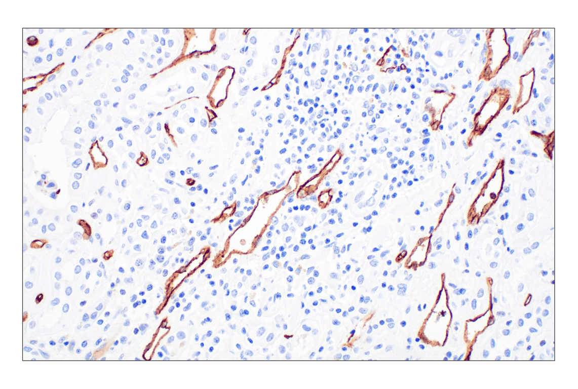 Immunohistochemistry Image 2: CD34 (QBEND/10) Mouse Monoclonal Antibody