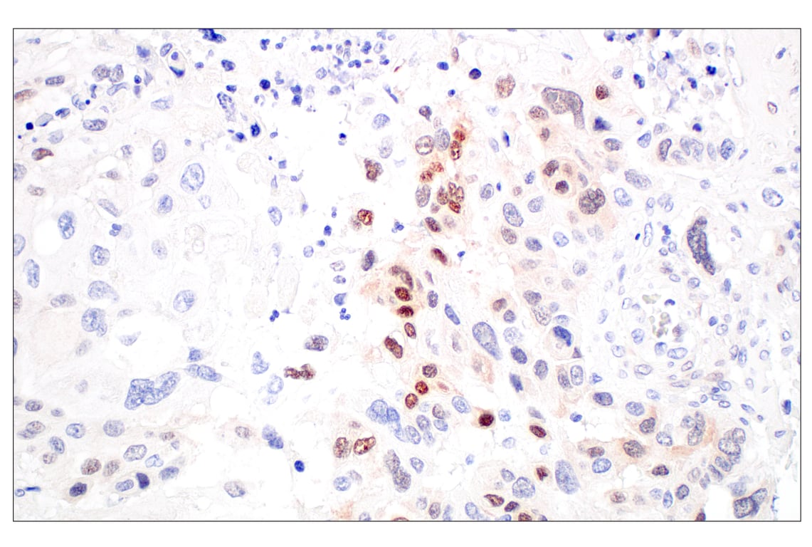 Immunohistochemistry Image 7: ARK5 (E4T2A) Rabbit Monoclonal Antibody