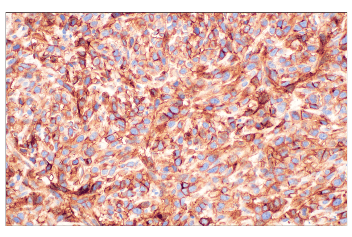 Immunohistochemistry Image 5: NT5E/CD73 (D7F9A) Rabbit Monoclonal Antibody
