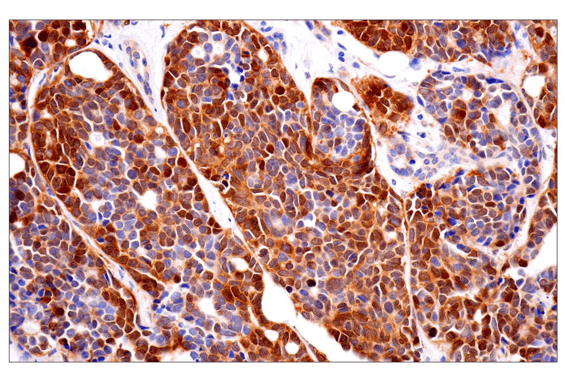 Immunohistochemistry Image 1: FAK (F7Z4C) Mouse Monoclonal Antibody (BSA and Azide Free)
