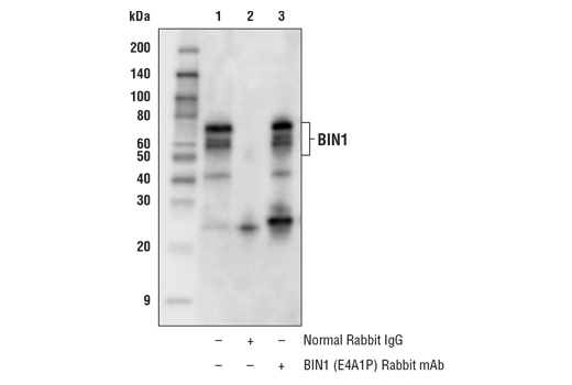 undefined Image 22: Late-Onset Alzheimer's Disease Risk Gene (Mouse Model) Antibody Sampler Kit