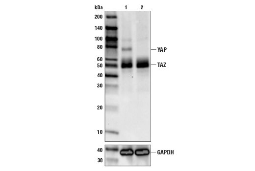 undefined Image 16: Hippo Signaling Antibody Sampler Kit