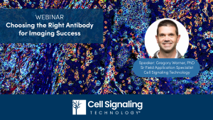 Learn how to select antibodies with application-specific validation to ensure reproducibility and success in your IF, IHC, and multiplex imaging assays. 