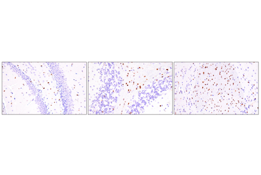 Immunohistochemistry Image 5: Olig2 (E6G6Q) Rabbit Monoclonal Antibody (BSA and Azide Free)