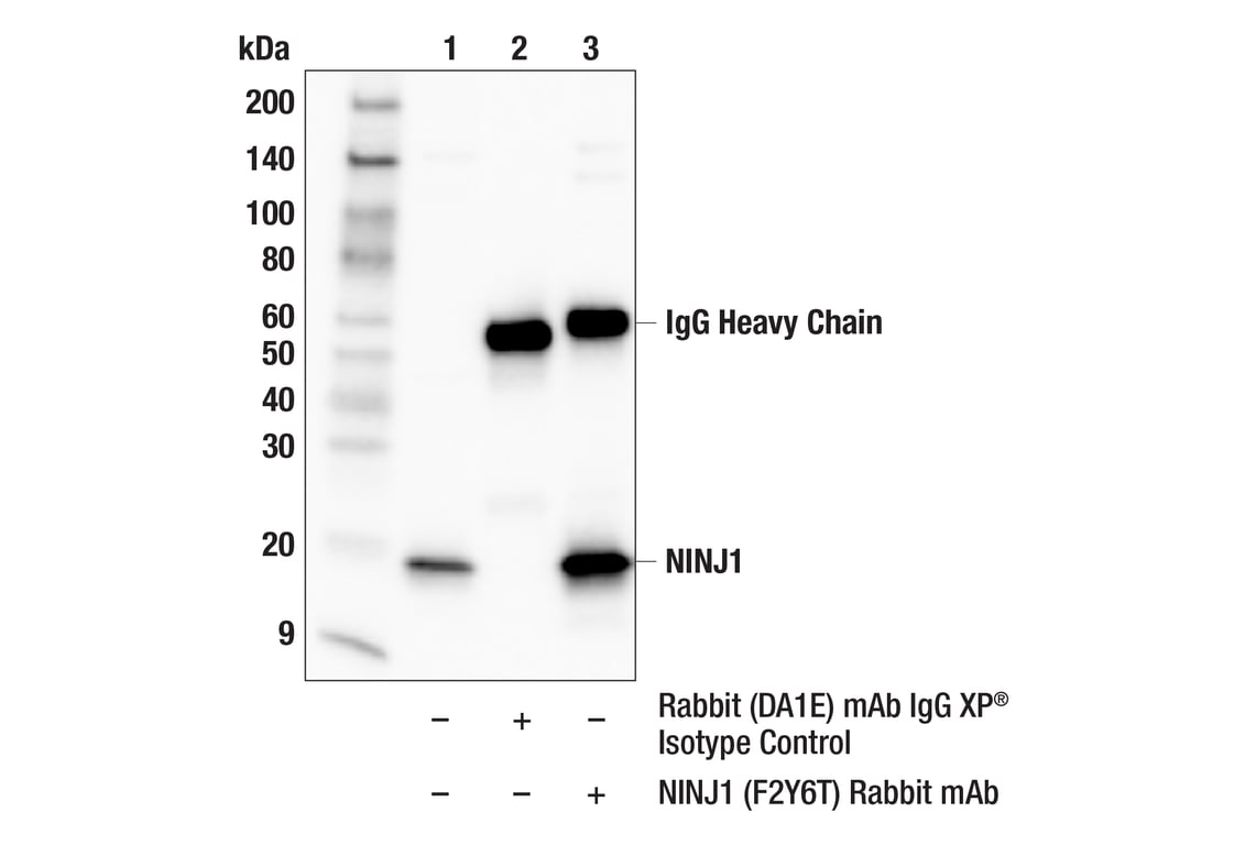 Immunoprecipitation Image 1: NINJ1 (F2Y6T) Rabbit Monoclonal Antibody