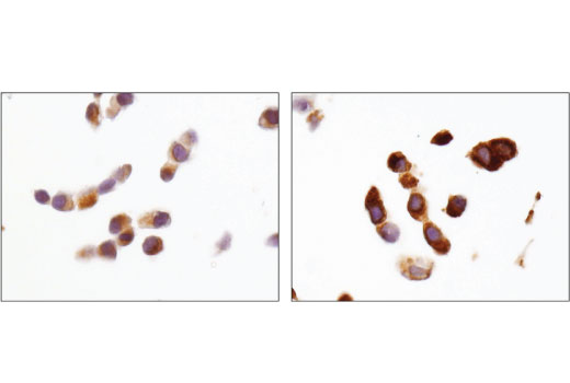 undefined Image 30: Mitophagy Antibody Sampler Kit
