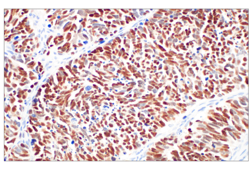 Immunohistochemistry Image 1: ASCL1 (E5S4Q) Rabbit Monoclonal Antibody (BSA and Azide Free)