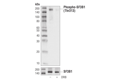 Western Blotting Image 2: Phospho-SF3B1 (Thr313) (D8D8V) Rabbit Monoclonal Antibody