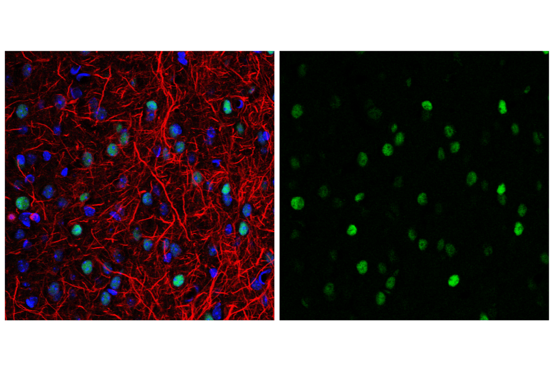 Immunofluorescence Image 1: c-Fos (9F6) Rabbit Monoclonal Antibody