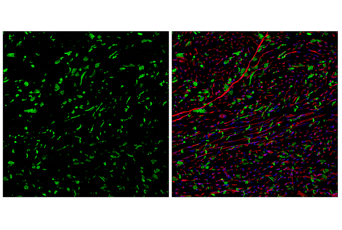 Immunofluorescence Image 2: N-Cadherin (D4R1H) Rabbit Monoclonal Antibody (Alexa Fluor<sup>®</sup> 488 Conjugate)