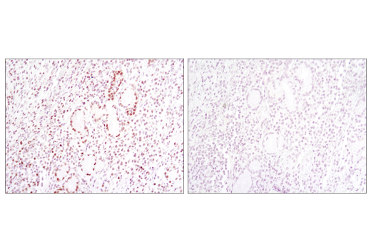Immunohistochemistry Image 3: TCF1/TCF7 (C63D9) Rabbit Monoclonal Antibody (BSA and Azide Free)