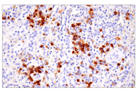 Immunohistochemistry Image 4: TNFRSF13C/BAFF-R (E3C1Q) Rabbit Monoclonal Antibody