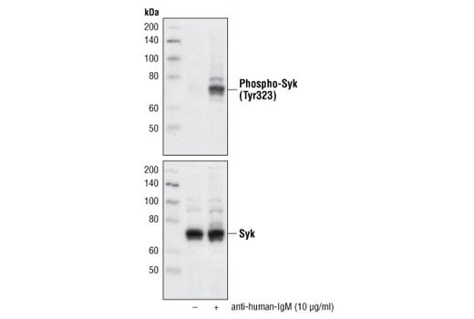 undefined Image 10: Phospho-Syk Antibody Sampler Kit