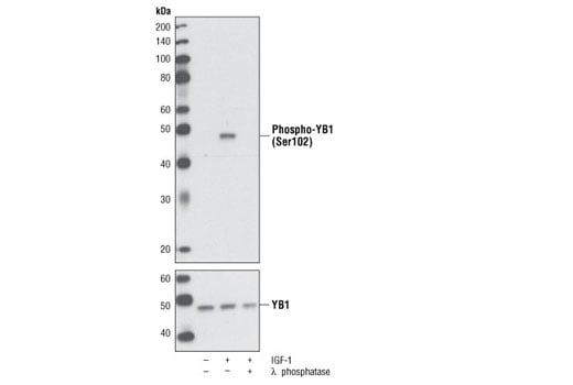 Phospho-YB1 (Ser102) (C34A2) Rabbit mAb | Cell Signaling Technology