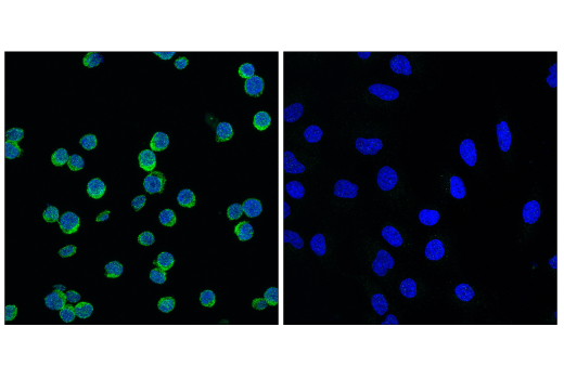 Immunofluorescence Image 1: BLNK (D3P2H) Rabbit Monoclonal Antibody (BSA and Azide Free)