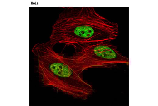 Immunofluorescence Image 1: DBC1 (3G4) Mouse Monoclonal Antibody