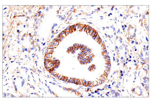 Immunohistochemistry Image 4: CD99 (PCB1) Mouse Monoclonal Antibody