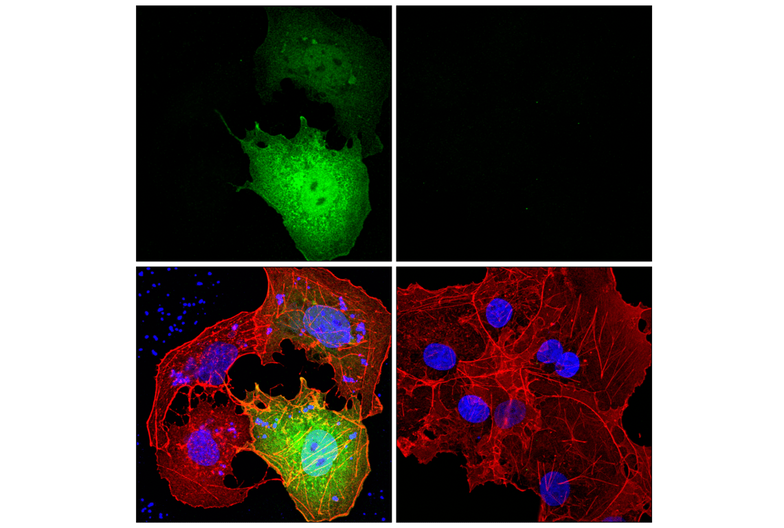 Immunofluorescence Image 1: beta-Gal (14B7) Mouse Monoclonal Antibody