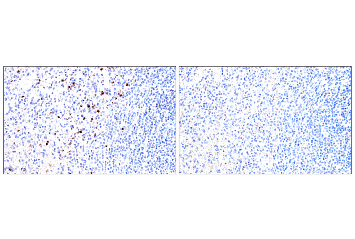 Immunohistochemistry Image 7: Perforin (IHC646) Mouse Monoclonal Antibody