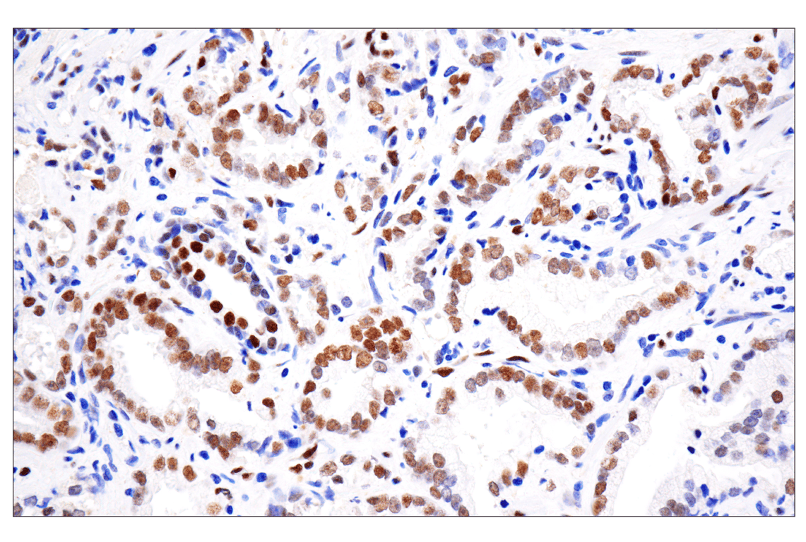 Immunohistochemistry Image 1: Phospho-Stat3 (Tyr705) (D3A7) Rabbit Monoclonal Antibody