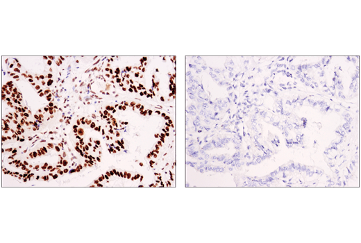 Immunohistochemistry Image 2: Asymmetric Dimethyl-SMARCC1/BAF155 (Arg1064) (D8I3U) Rabbit Monoclonal Antibody