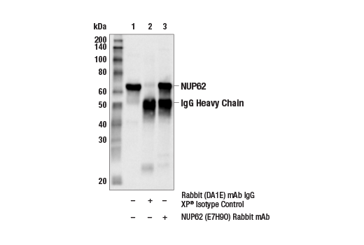Immunoprecipitation Image 1: NUP62 (E7H9O) Rabbit Monoclonal Antibody