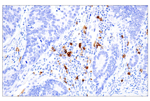 Immunohistochemistry Image 4: CD20 (L26) Mouse Monoclonal Antibody