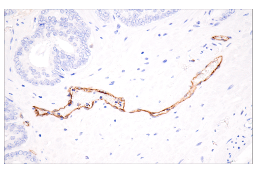 Immunohistochemistry Image 2: CD62P/P-Selectin (E8Q1W) Rabbit Monoclonal Antibody
