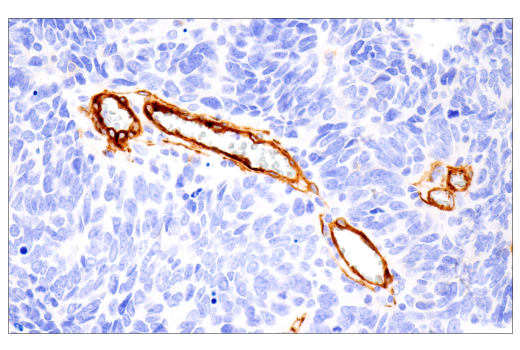 Immunohistochemistry Image 3: Integrin alpha1/CD49a (E9K2J) Rabbit Monoclonal Antibody