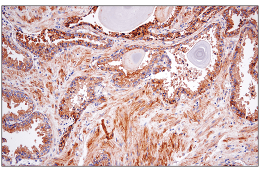 Immunohistochemistry Image 3: CD151 (E4I9J) Rabbit Monoclonal Antibody