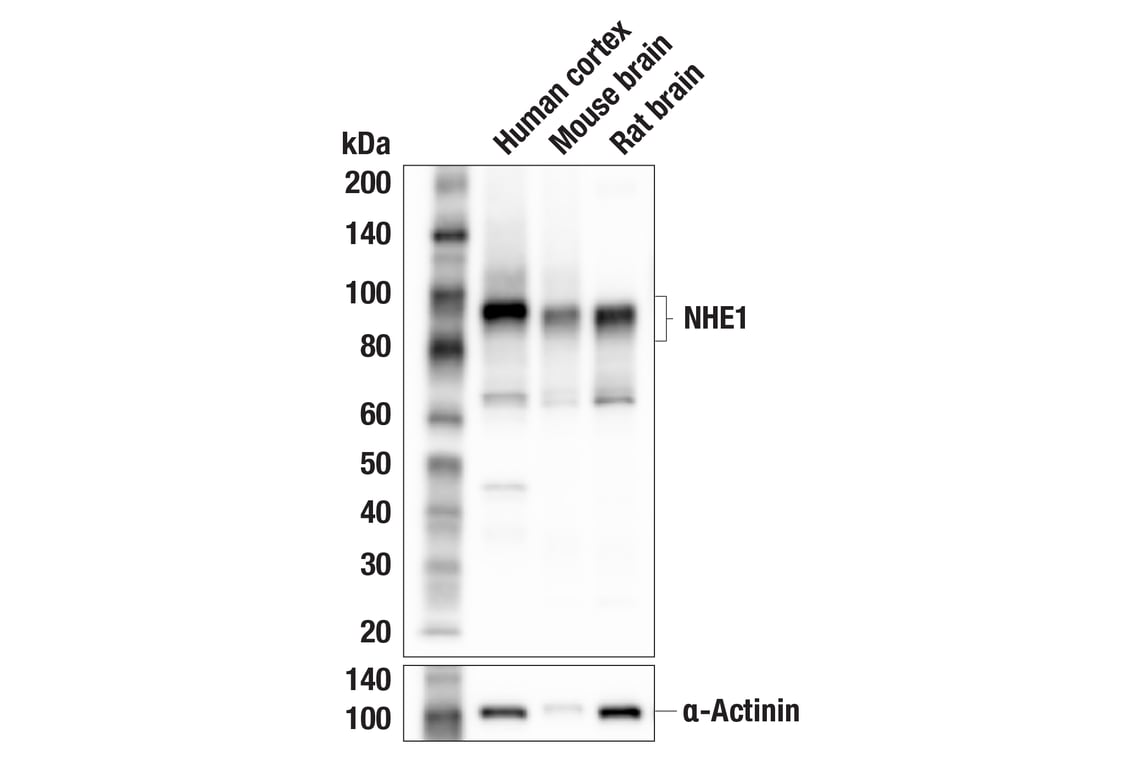 Western Blotting Image 2: NHE1 (E2S8S) Rabbit Monoclonal Antibody