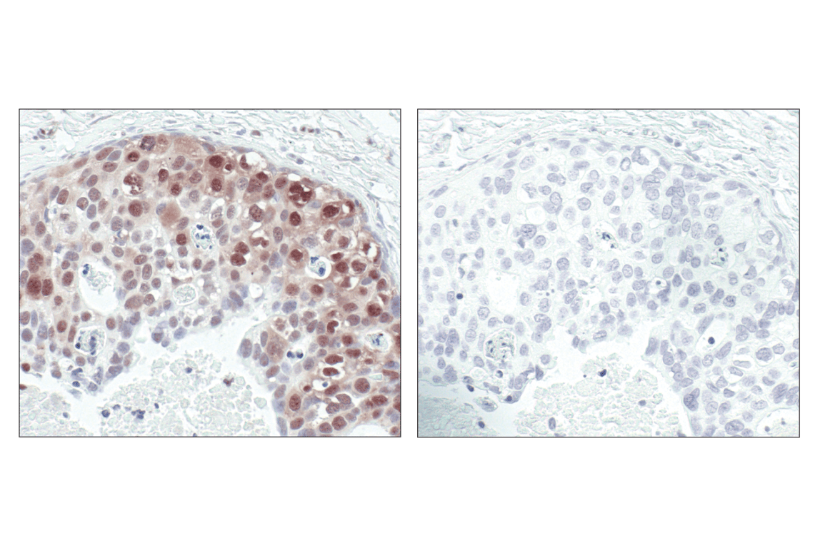 Immunohistochemistry Image 3: Phospho-Akt Substrate (RXXS*/T*) (110B7E) Rabbit Monoclonal Antibody